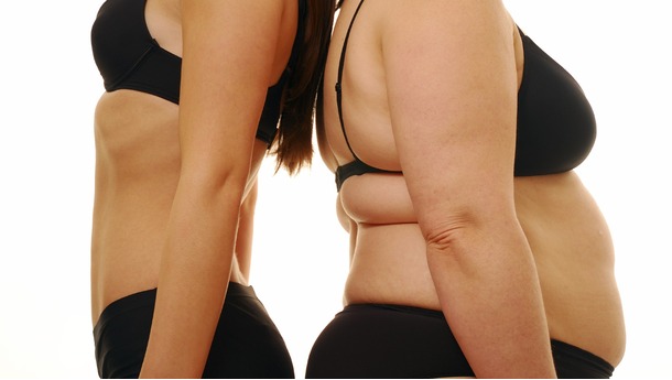 zayiflama sonrasi-321.jpg